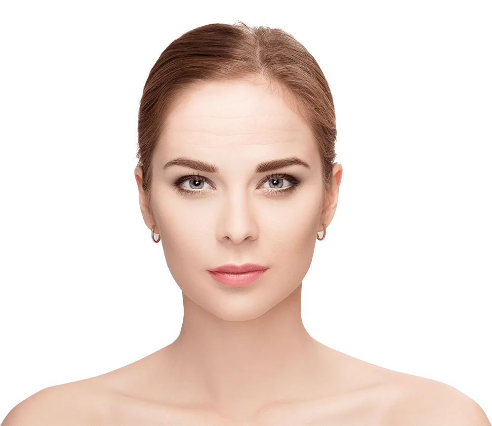 Horizontal forehead lines
