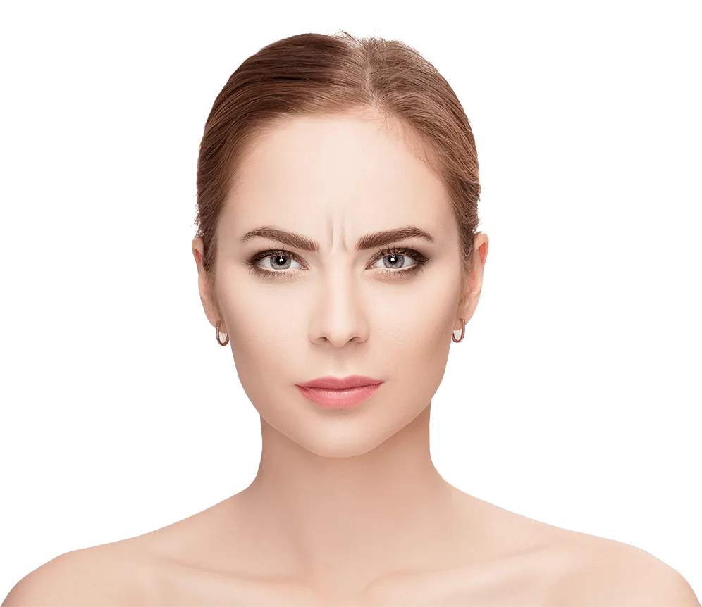 Frown lines