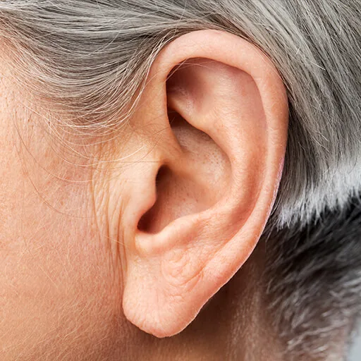 Large earlobes
