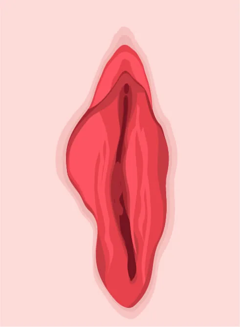 Öncesi – Varyant 1