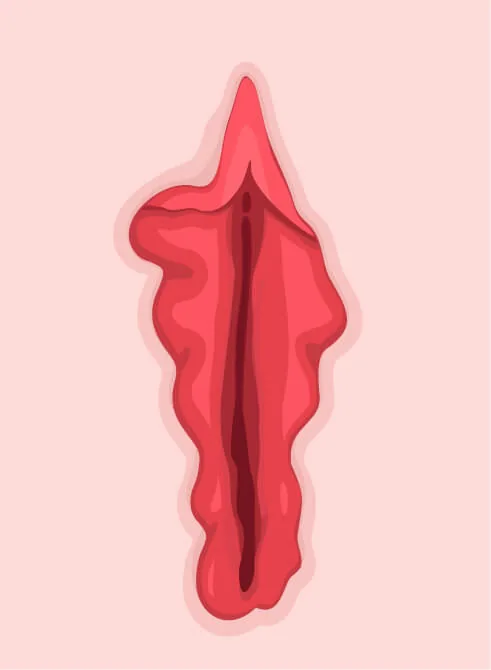 Öncesi – Varyant 3